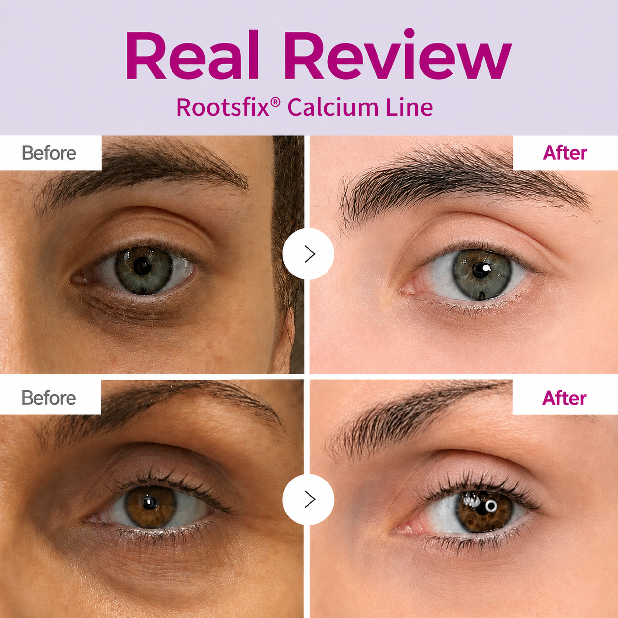 🔥LAST DAY 50% OFF!!Rootsfix® Korean Calcium Dark Spot Eye Cream