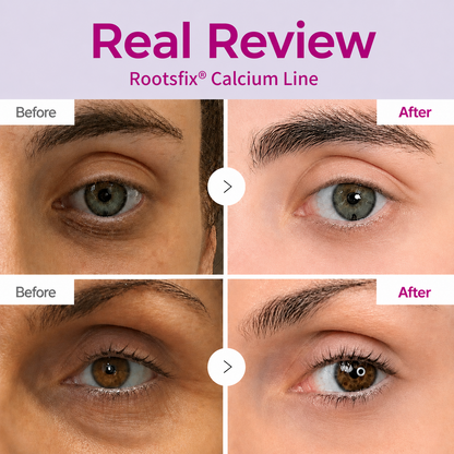 🔥LAST DAY 50% OFF!!Rootsfix® Korean Calcium Dark Spot Eye Cream