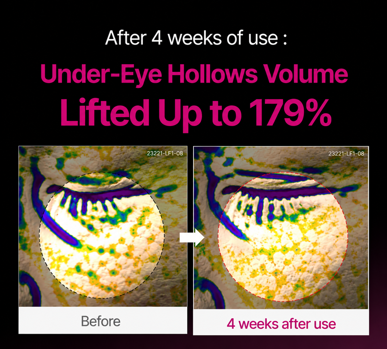 🔥LAST DAY 50% OFF!!Rootsfix® Korean Calcium Dark Spot Eye Cream